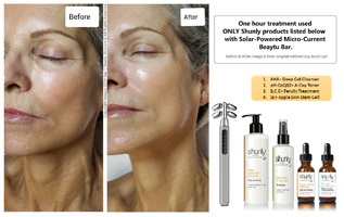Before and After using Solar-Powered Micro-Current Beauty Bar
